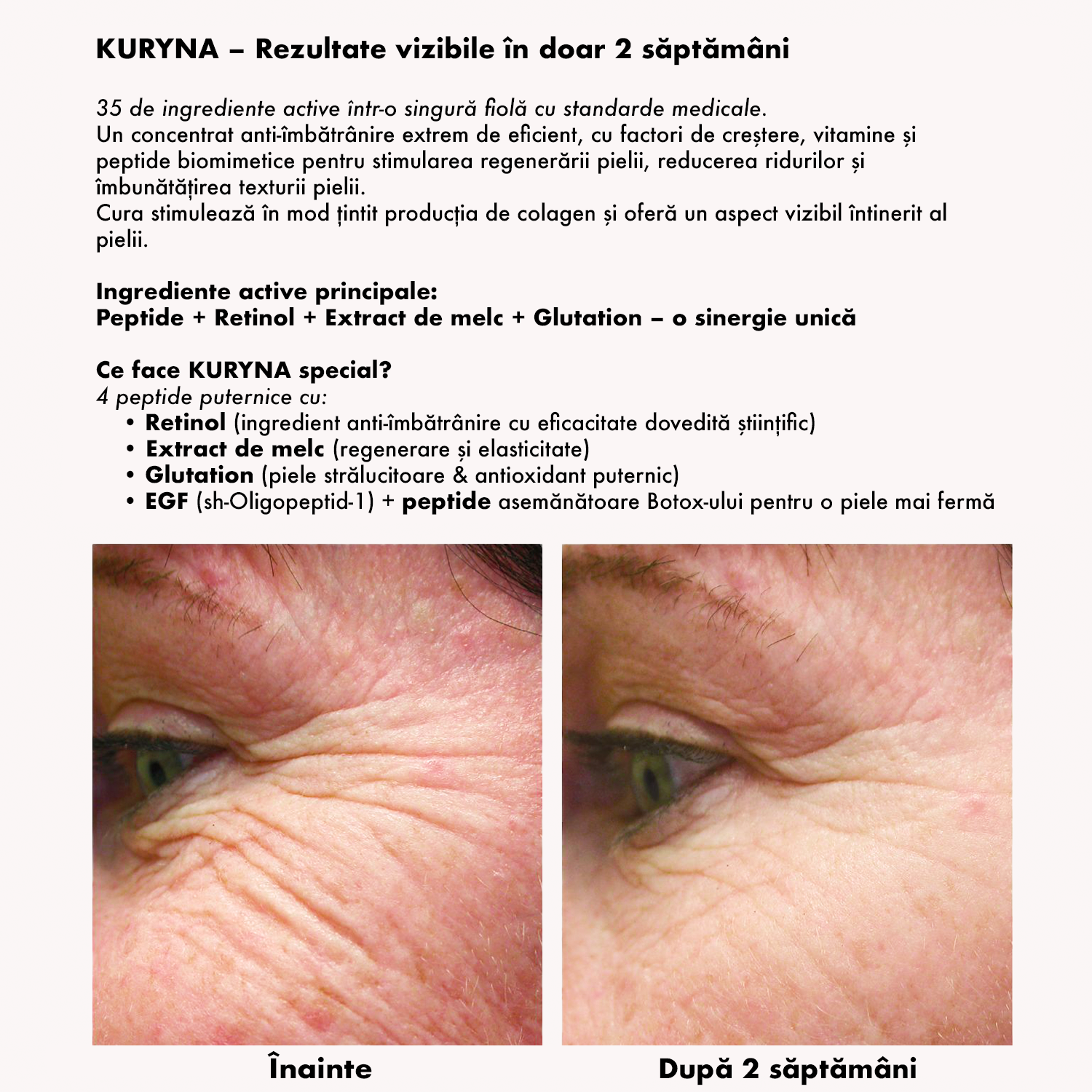 Kit GoldenSkin Microneedling (2 dispozitive) + Kuryna® Fiole (4 buc.)